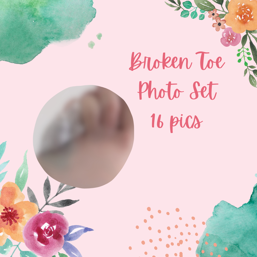 Broken Toe Photo Set