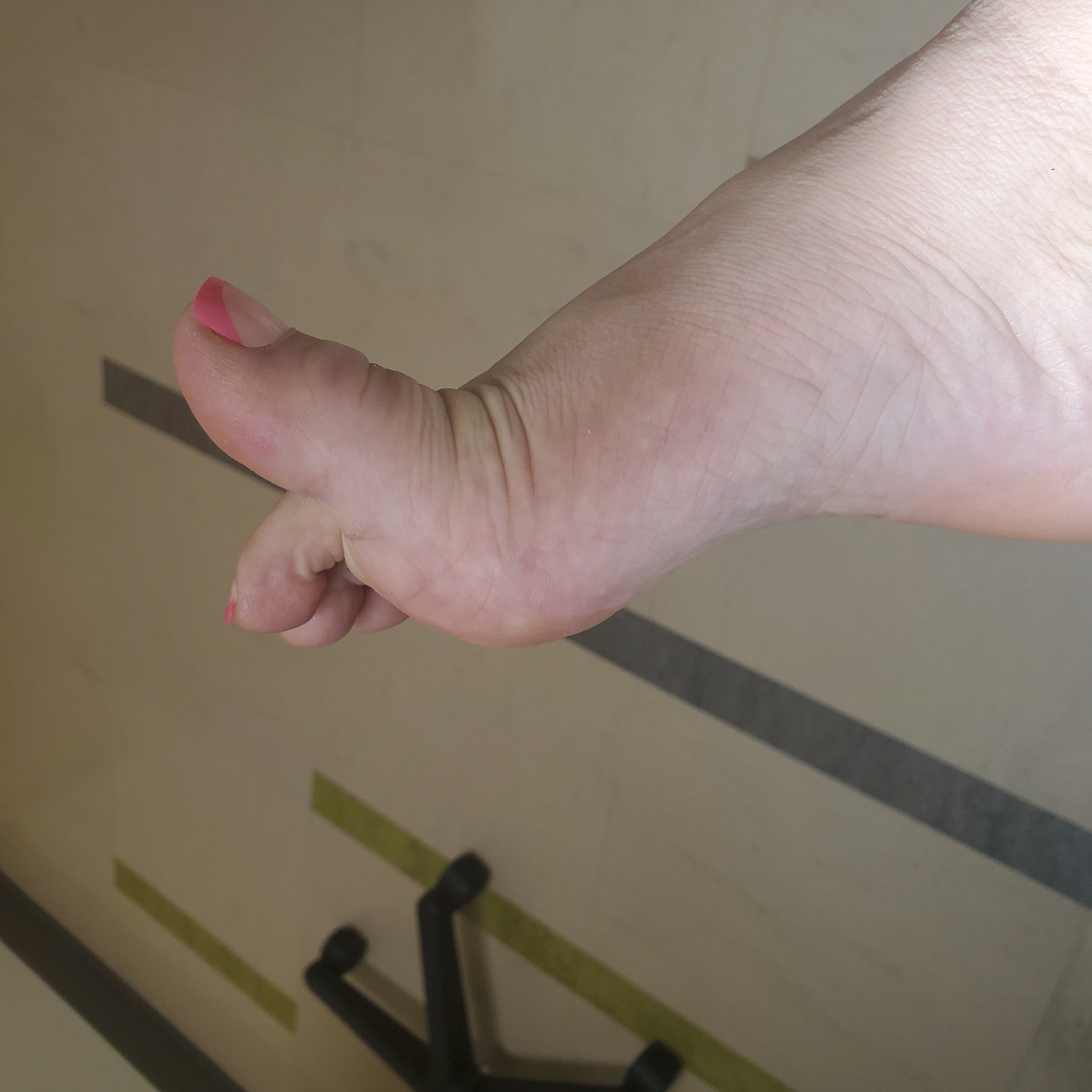 Rare Toes EbonyGoddessT - Rare Soles: Amputated Toes - iWantClips
